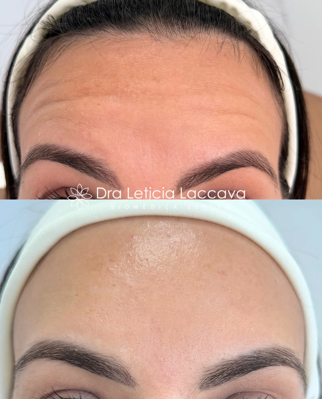 Procedimento