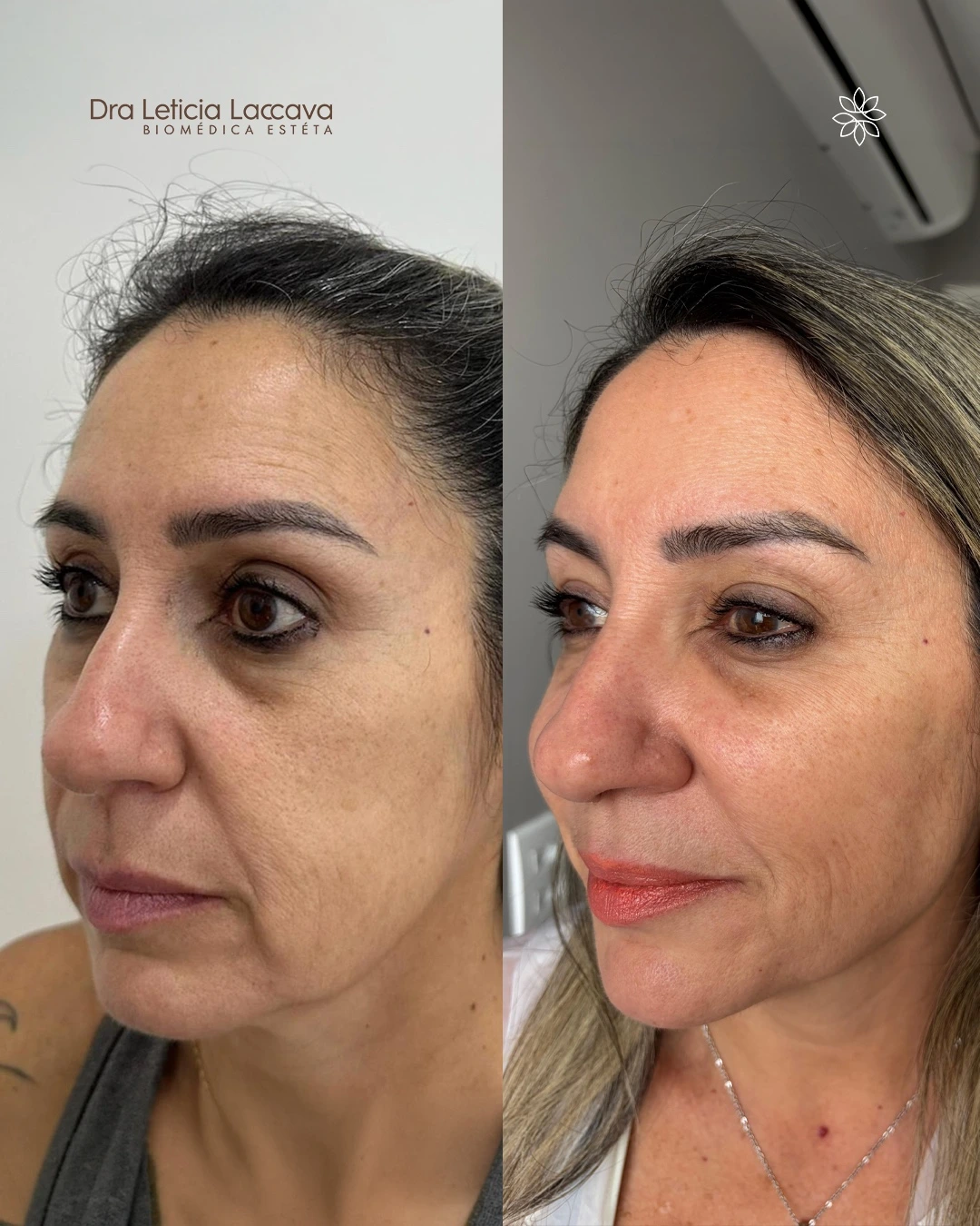 Procedimento